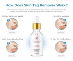 Amarose Skin Tag Remover Reviews: Serum, Uses & Work?